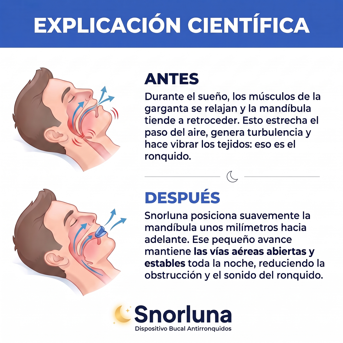Explicación científica: antes y después del avance mandibular con Snorluna